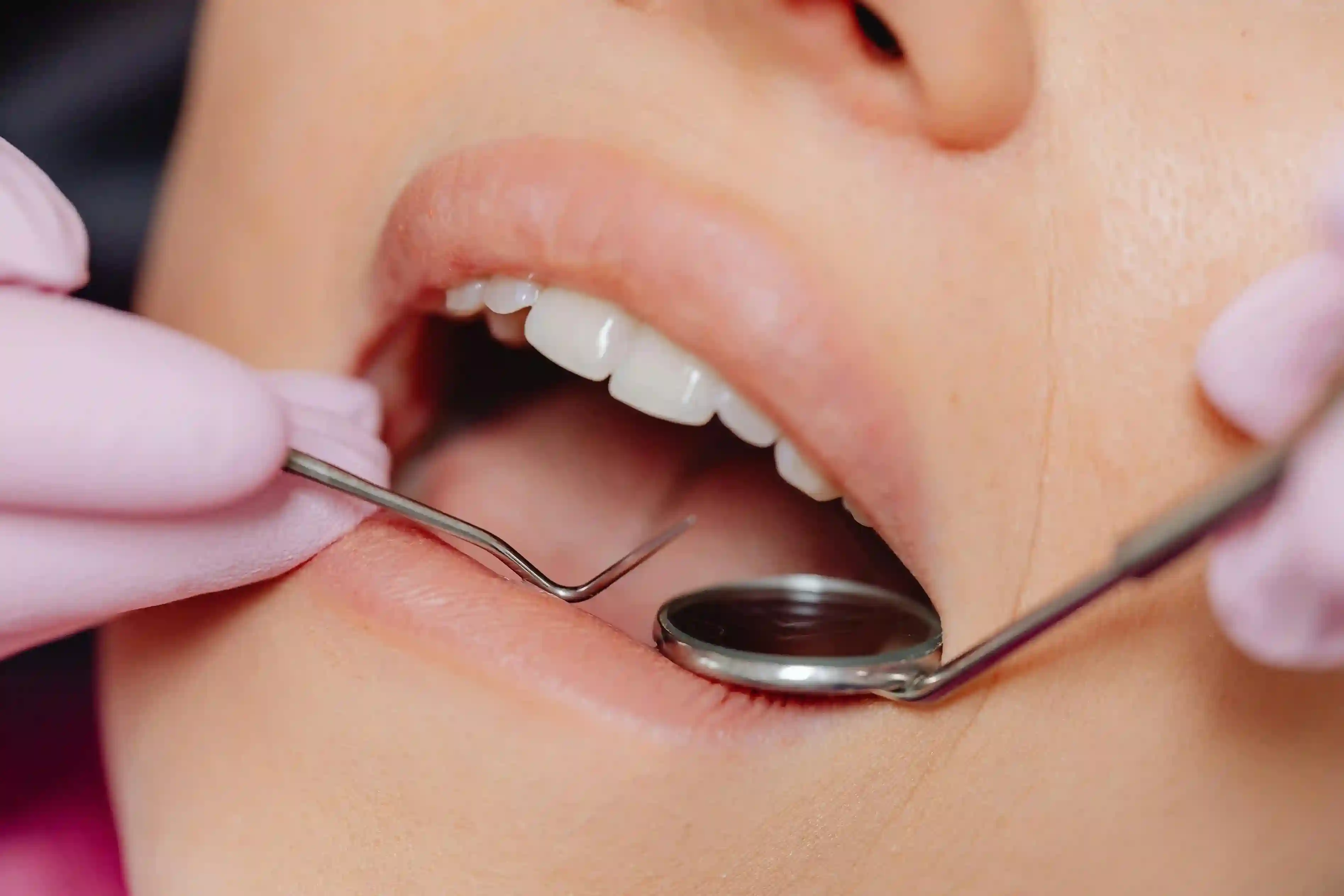 Periodoncia en Centro Dental Híjar, Híjar, Granada